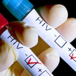 На Сахалине увеличилcя рост заболеваемости ВИЧ