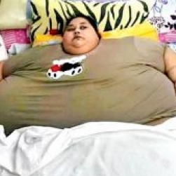 Самая тяжелая женщина мира «сбросила» 330 килограммов